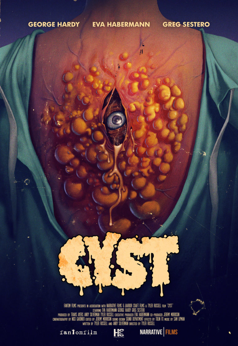 CYST poster